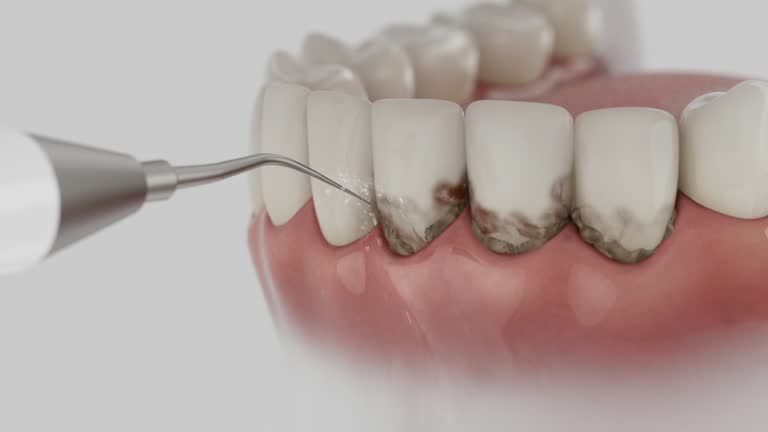 Reliable Dental contractor in Universal City, TX by Smile Center Dentistry